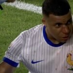 Mbappe le nez casse2