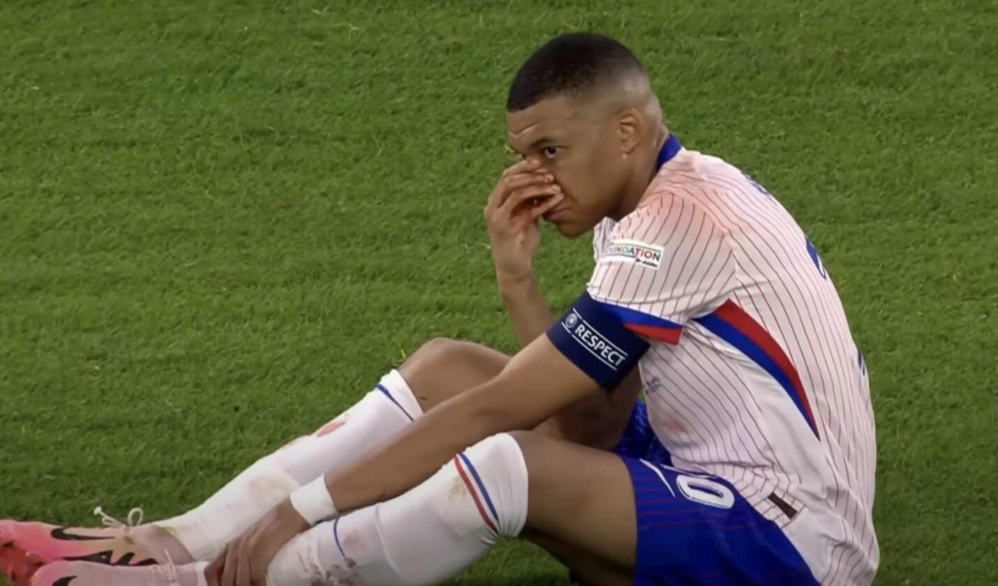 Mbappe le nez casse3 1