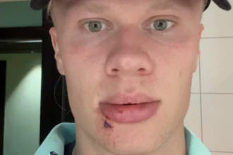 Erling Haaland se blesse… en descendant du bus.